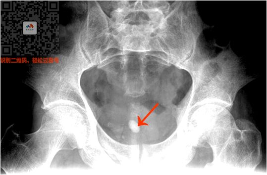 执医技能:X线阅片,全是套路,超简单