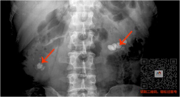 执医技能:X线阅片,全是套路,超简单