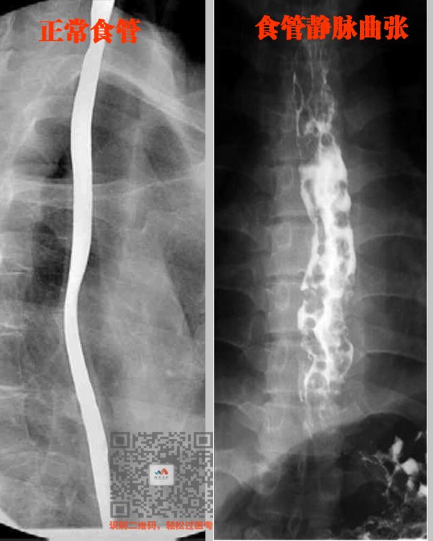 执医技能:X线阅片,全是套路,超简单