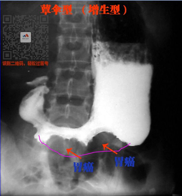 执医技能：X线阅片，全是套路，超简单