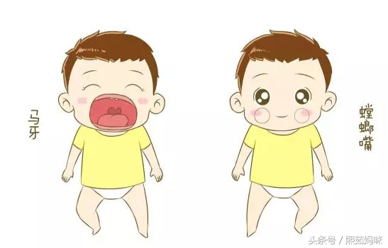 新生宝宝特有的生理现象,新生宝宝的常见现象