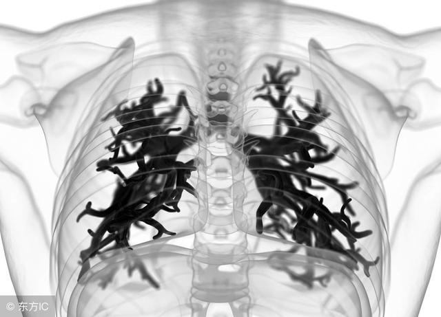 支气管炎咳嗽怎么判断,支气管炎干咳怎么治最有效