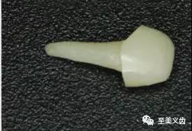 德国的二氧化锆义齿,义齿氧化锆打磨流程及数据