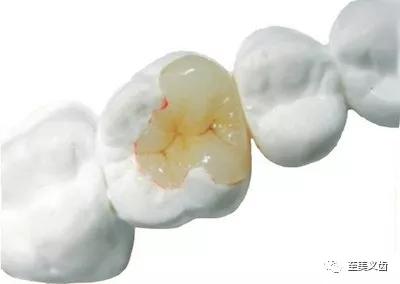 德国的二氧化锆义齿,义齿氧化锆打磨流程及数据