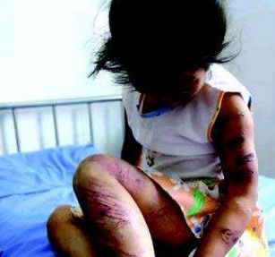 8岁女孩突然浑身打颤晕厥,8岁女童受吓发热后精神异常