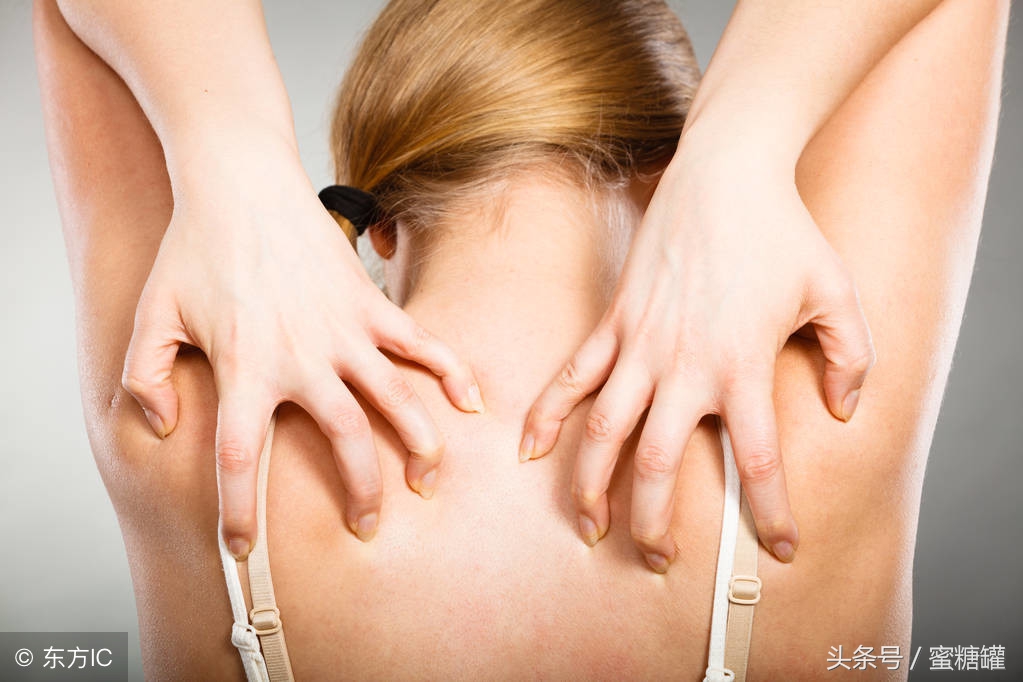 夏天湿疹最简单的自愈方法,夏天湿疹怎么快速消除