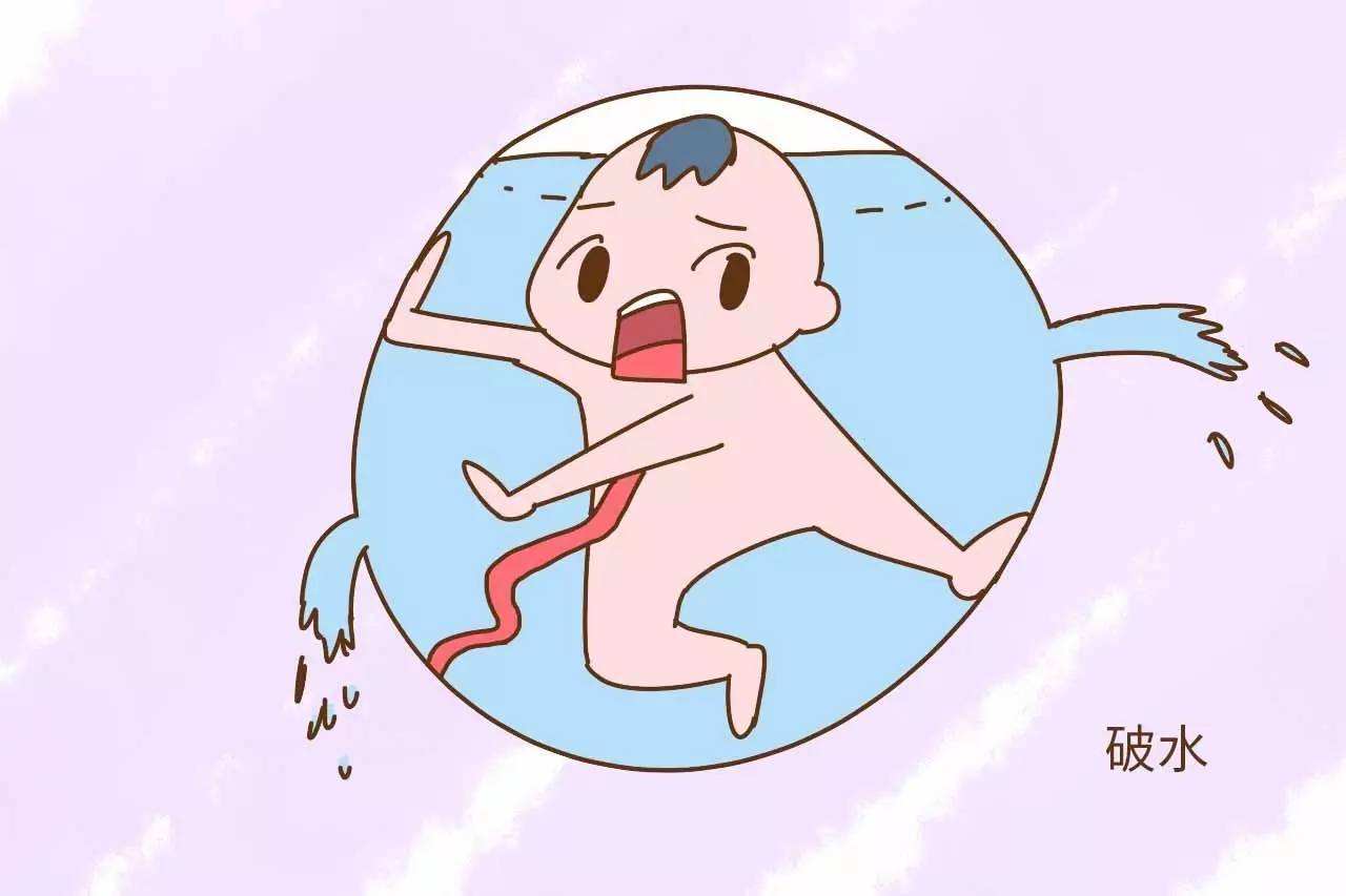 孕妇破水有什么现象,孕妇破水正确处理措施