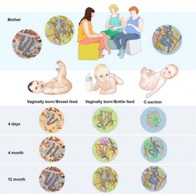 肠道健康菌群与孕产妇的关系,孕产妇必读