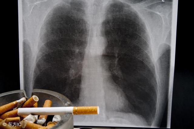 肺癌手术后怎么知道复发症状,肺癌复发最好治疗方法