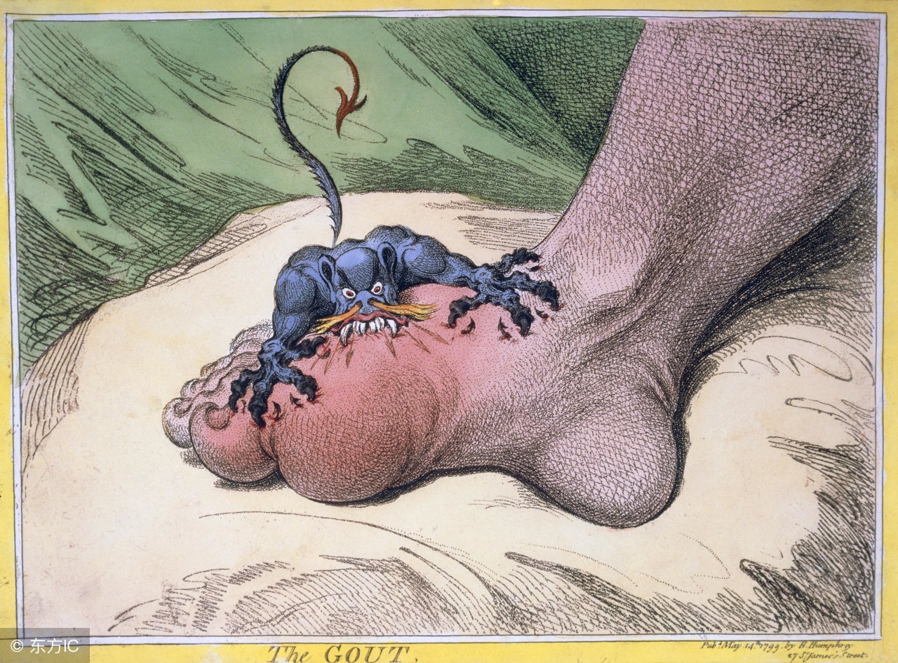 尿酸高对肾脏的影响有哪些,高尿酸血症的明显征兆