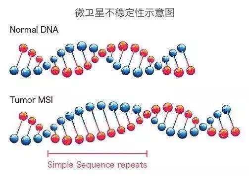 pd1有没有让癌症消失,打pd1后肿瘤缓解