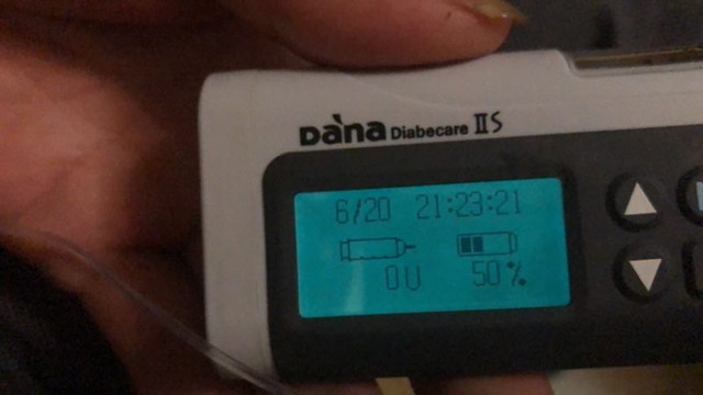 糖友餐二血糖9左右严重吗,糖友餐后二小时血糖值8.6正常吗