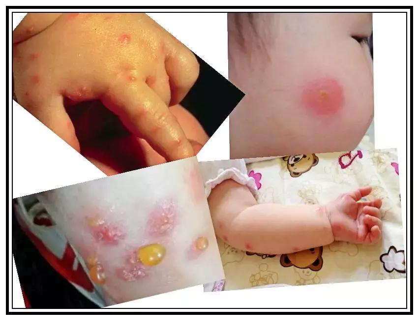 与宝宝并肩作战的每个夏天!