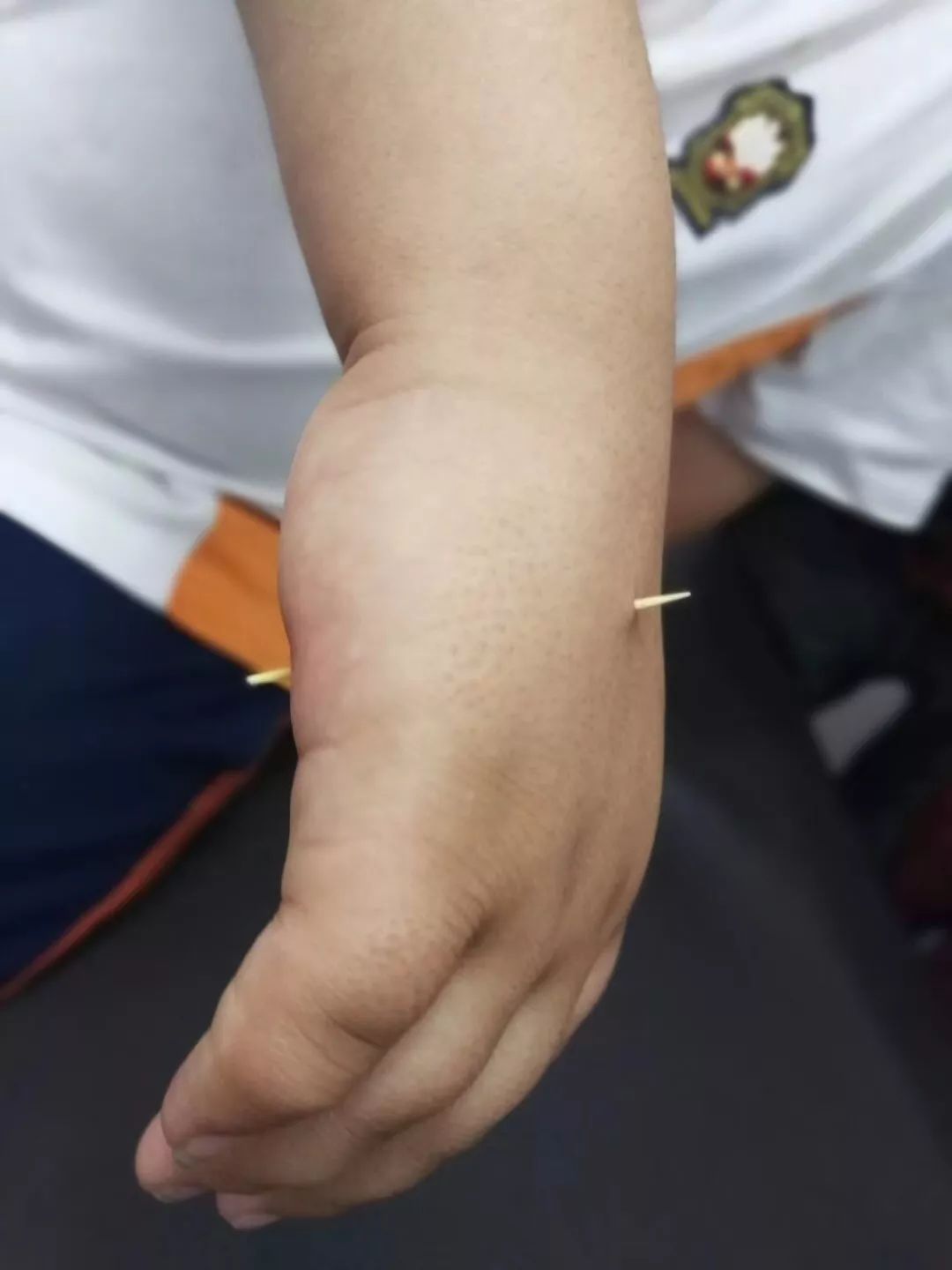 看着都疼熊孩子,熊孩子看着都疼原版