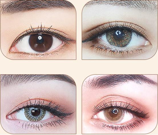 埋线双眼皮一般能保持几年,埋线双眼皮10年效果图