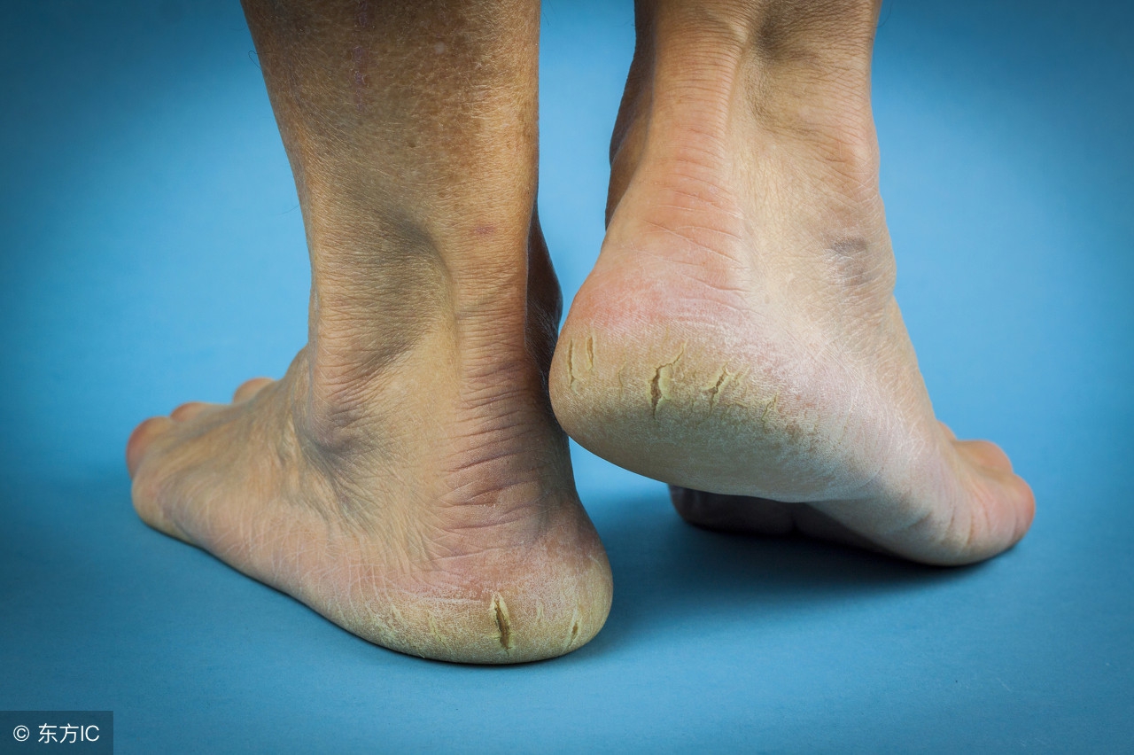 手术后手脚脱皮是什么原因导致的,小孩手脚脱皮是什么原因