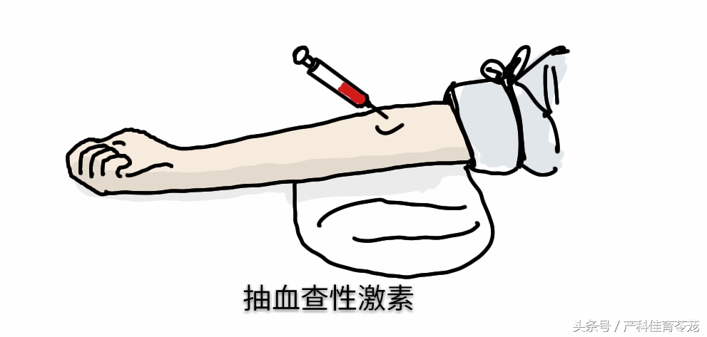 同是性激素检查，您和她的可不一样