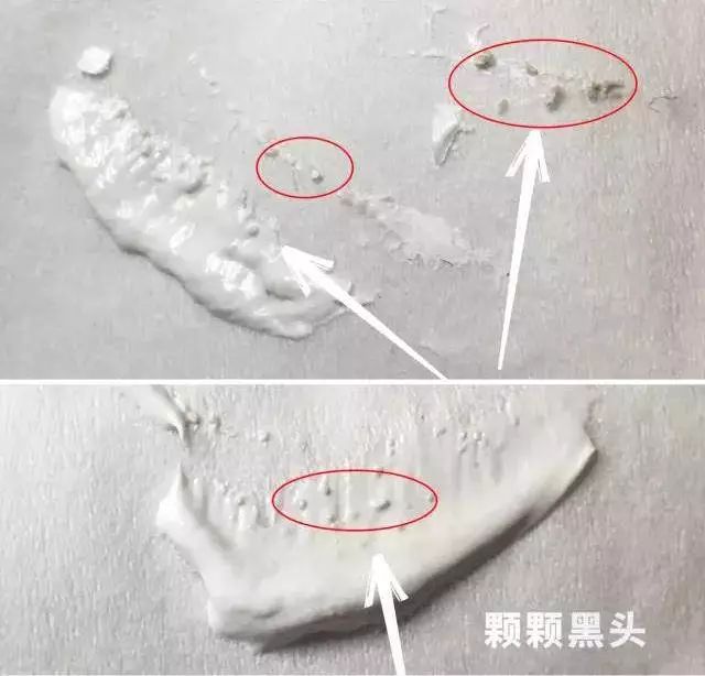 好物去黑头祛痘,去黑头粉刺面霜