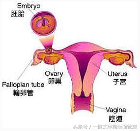 这几个症状提示宫外孕准妈妈一定要警惕！