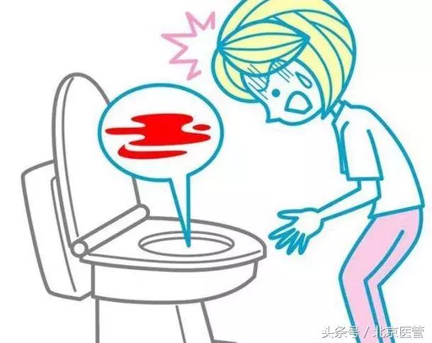 想做无痛胃肠镜?检查前这些注意事项必读!