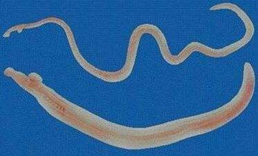 喝生水对身体有什么危害,喝生水会有什么样的后果