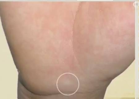 手健康有多重要,手型看健康