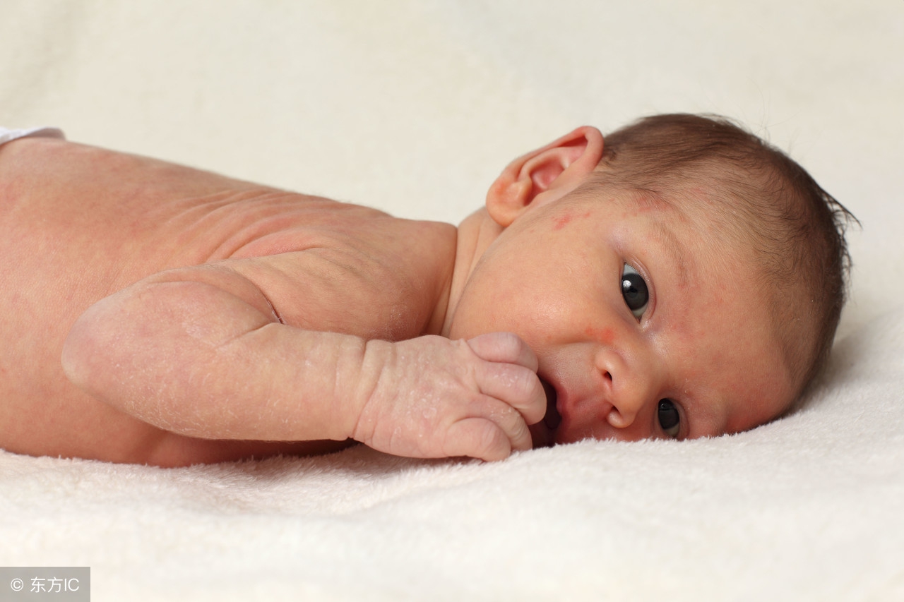 湿疹太顽固几招让湿疹不再来,一招教你解决湿疹赶紧收藏