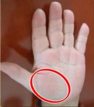 手健康有多重要,手健康的表现