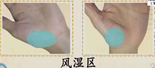 手健康有多重要,手健康的表现