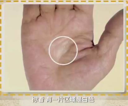 手健康有多重要,手健康的表现