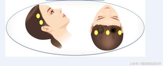 脸部肌肉下垂怎样变得紧致医美,脸部肌肉下垂怎么办