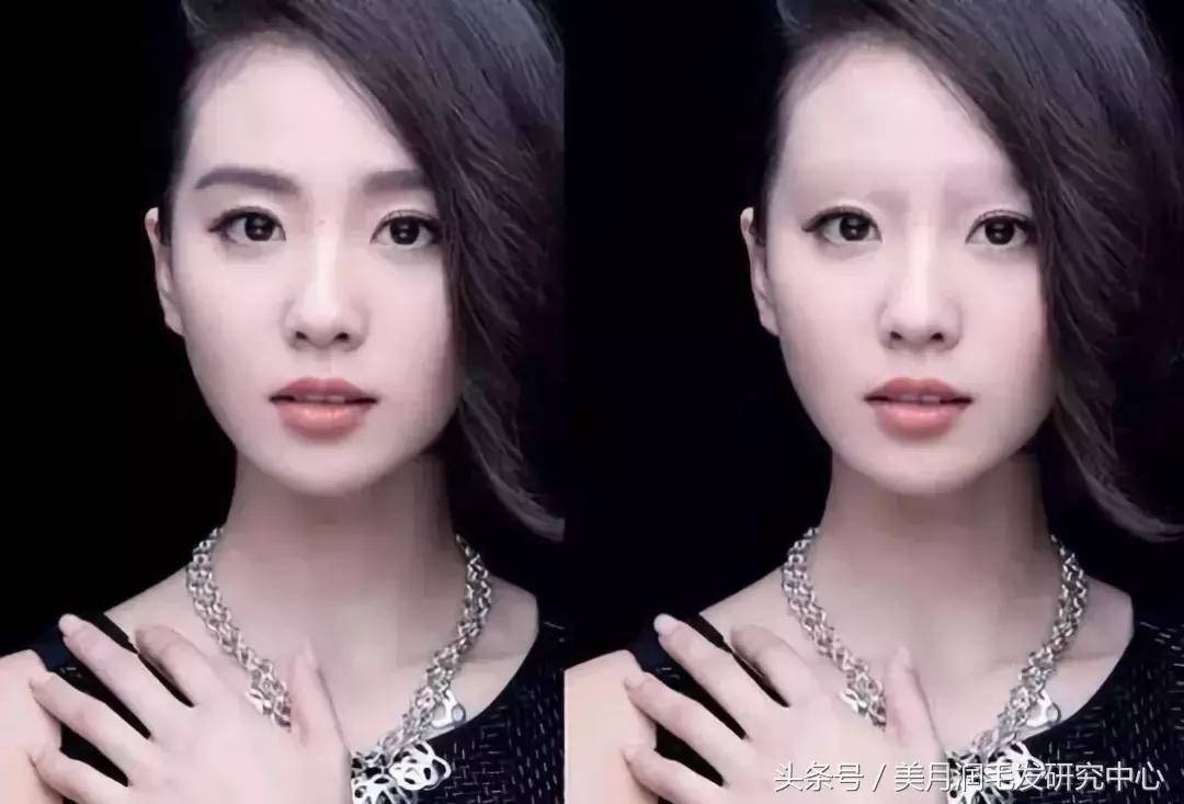 没有眉毛是什么样的,没有眉毛是有多么不方便