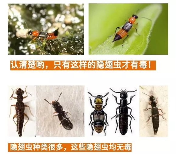 公园转一圈小孩差点毁容,十几个月大的孩子几乎毁容