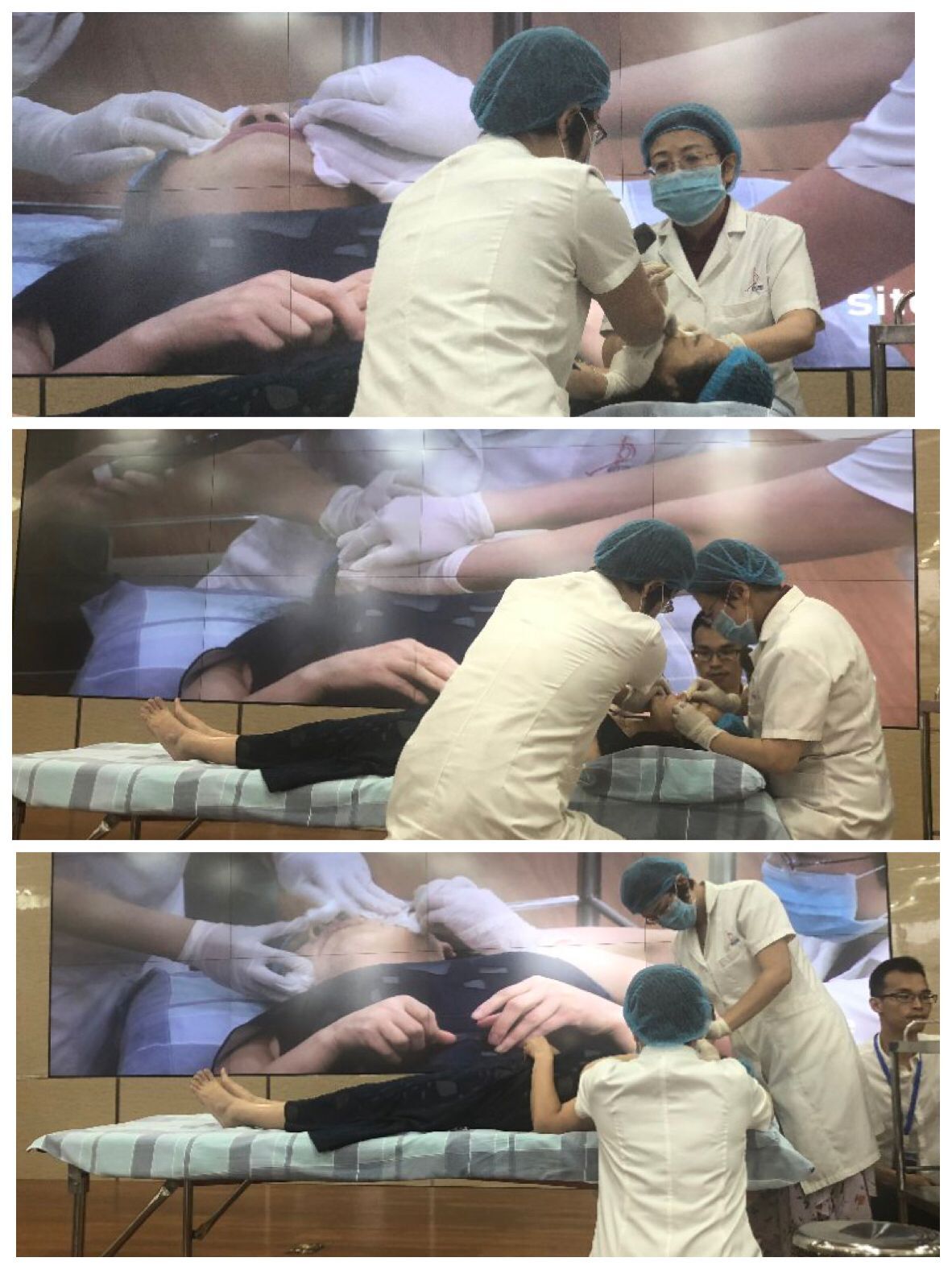 胸锁乳突肌浮针治疗视频,胸锁乳突肌黏连做小针刀能好吗