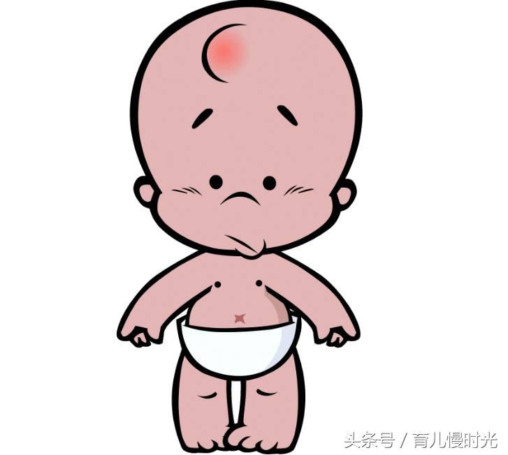 孩子摔倒碰到头后需要注意什么,小孩子摔倒头部起包怎么处理