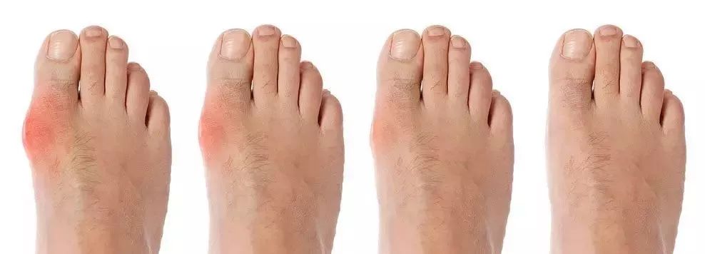 女孩倒地不起送医后发现中毒,10岁女孩中毒晕倒