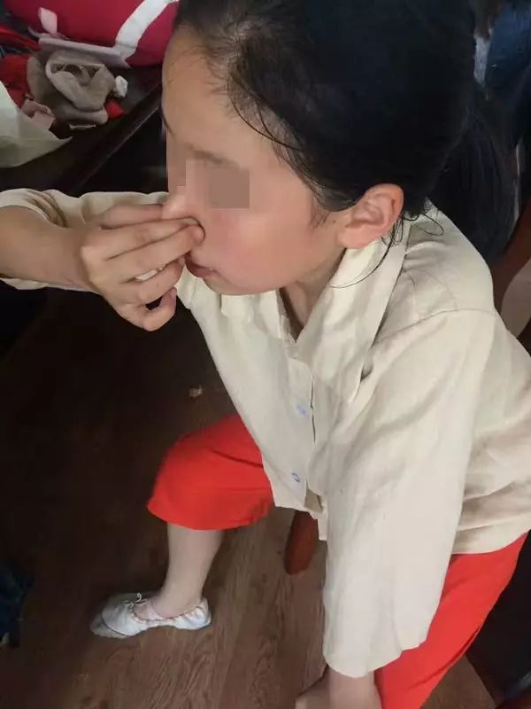 孩子流鼻血了怎么办最有效,小孩流鼻血怎么办快速解决方法