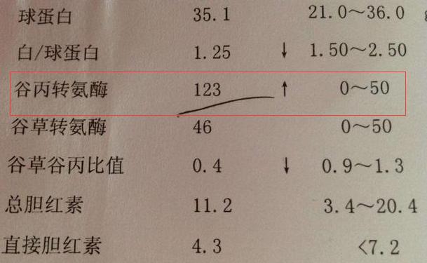 转氨酶偏高,说明肝脏已经严重受损,枸杞一种吃法,降酶防肝癌