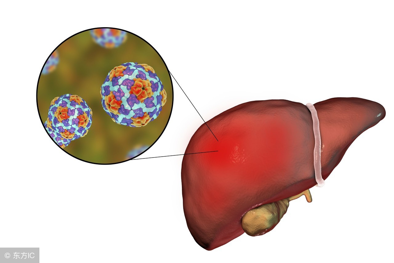 转氨酶偏高,说明肝脏已经严重受损,枸杞一种吃法,降酶防肝癌