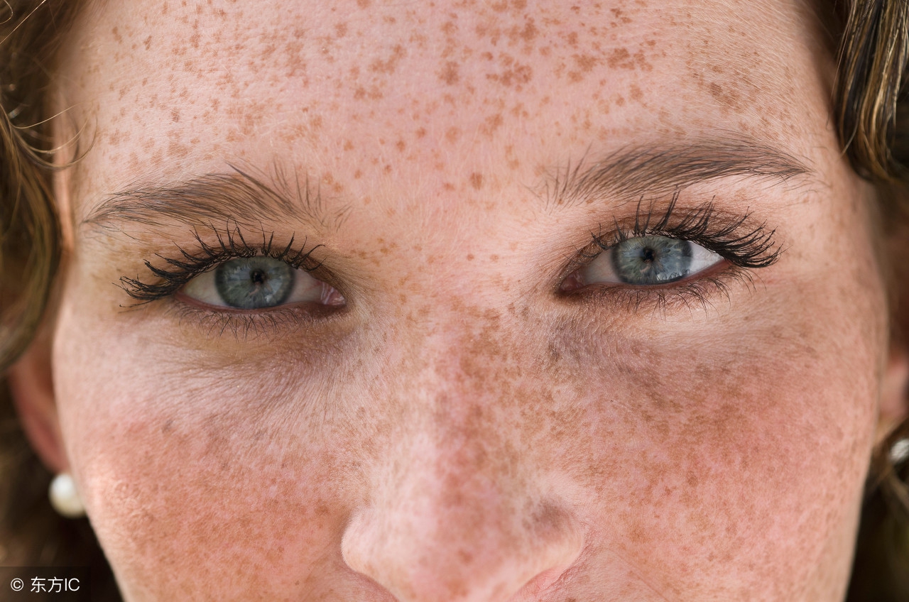 吃什么能消除色素沉着淡斑,除褐斑偏方