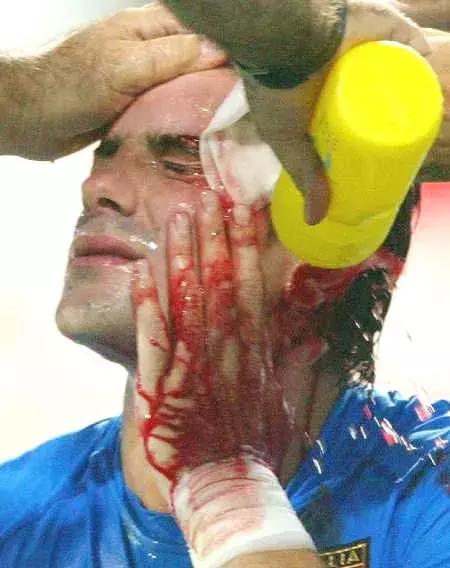 看世界杯真实反应,看世界杯后遗症