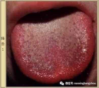 感觉阴虚阳虚都有一点怎么判断,看舌头判断阴虚阳虚脾虚图片