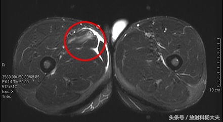 看了这些图，才知道，其实足球是比较*力暴**的运动