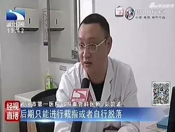 女儿用84消毒液给母亲治脚气,致其脚趾破溃只能截掉!