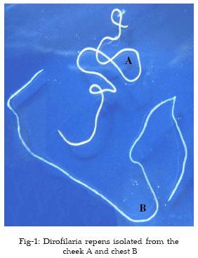 为什么被蚊子叮了会出一个包,蚊子叮的包会不会有寄生虫