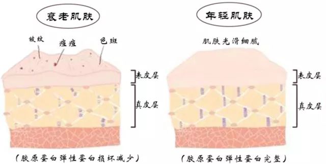 不用针提拉紧致皮肤的机器,冻龄防早衰精华乳
