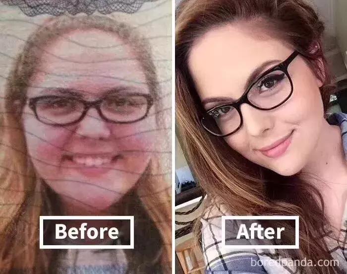 减肥前后真的能判若两人吗,减肥对一个人的容貌影响视频