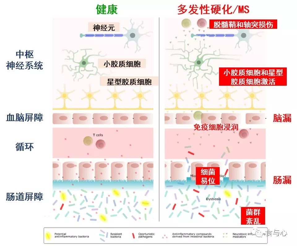肠漏症的三大指标,肠漏症和脑漏症
