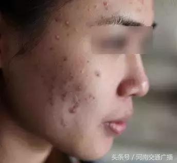 面部皱纹多用什么牌子的面膜,脸部暗沉哪款面膜最好用