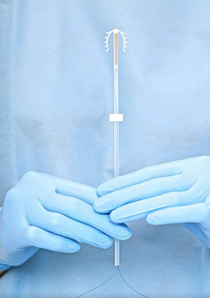 上环能不能有效的避孕,女人上环危险